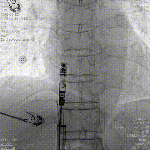 xIfVNMMd_c4jZ.gif?auth_key=1777219199-0-