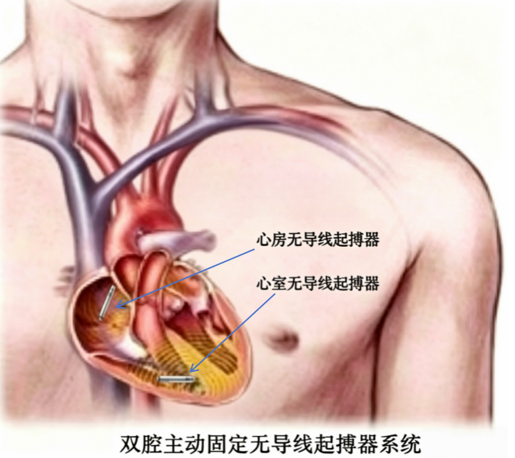 3d58e9108c464d699bcb3e8099efe7cc.png upfile